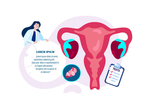 Best PCOS/PCOD treatment in Andheri